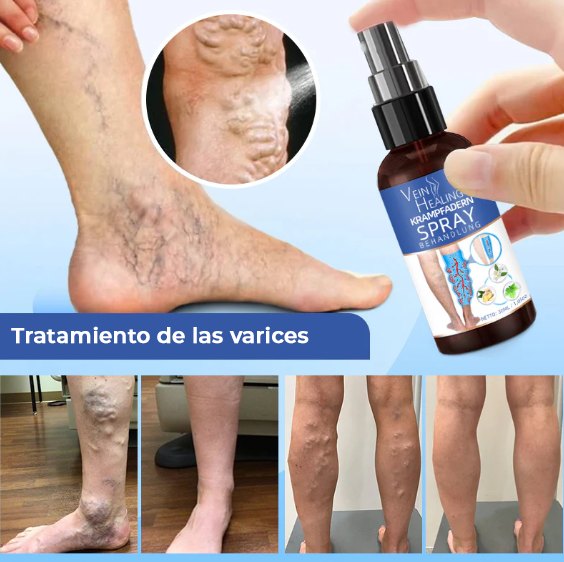 HealVein™ Spray para varices | El tratamiento Nº1 para las venas varicosas recomendado por cardiólogos