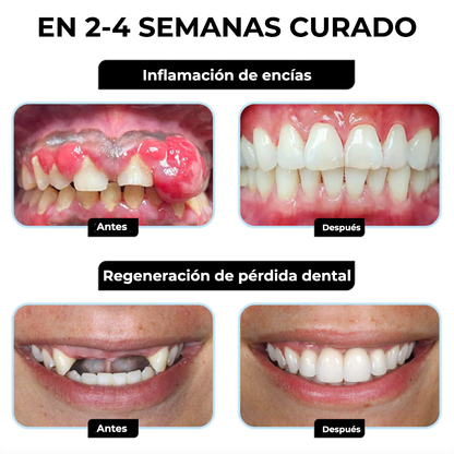 SlimBee™ | Elimina el 97% de los problemas dentales en solo 7 días