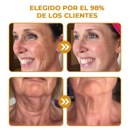 CleanBotox™ Luce hasta 10 años más joven en tan solo 14 días