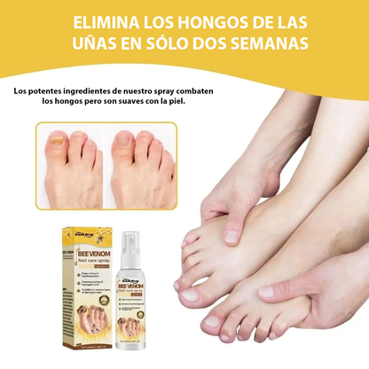 FungaBee® Spray para el cuidado de las uñas con veneno de abeja | ¡De suave a hermoso en sólo 14 días!