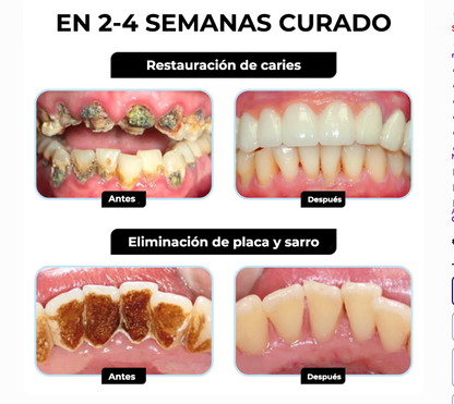 SlimBee™ | Elimina el 97% de los problemas dentales en solo 7 días