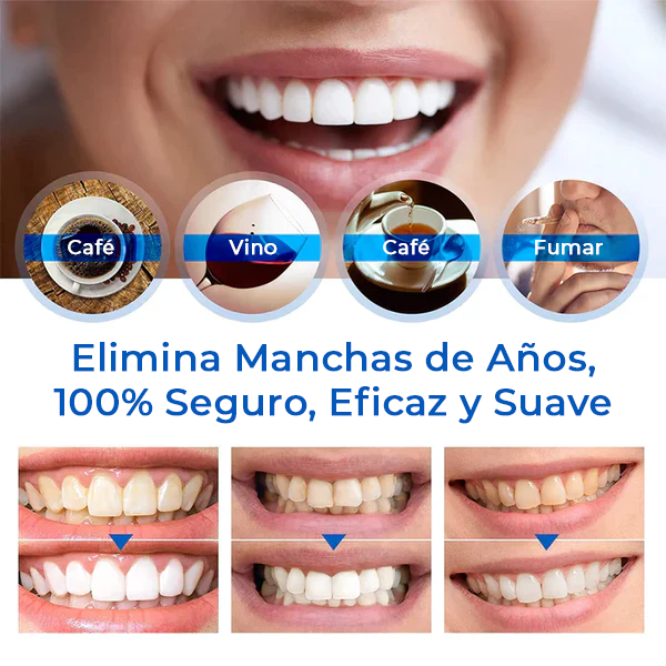 SmilePen™ | Blanquea tus dientes y elimina manchas en un 95% en 7 días