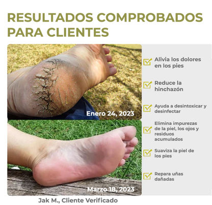 MediFoot™ | El tratamiento Nº1 para restaurar la salud y belleza de tus pies