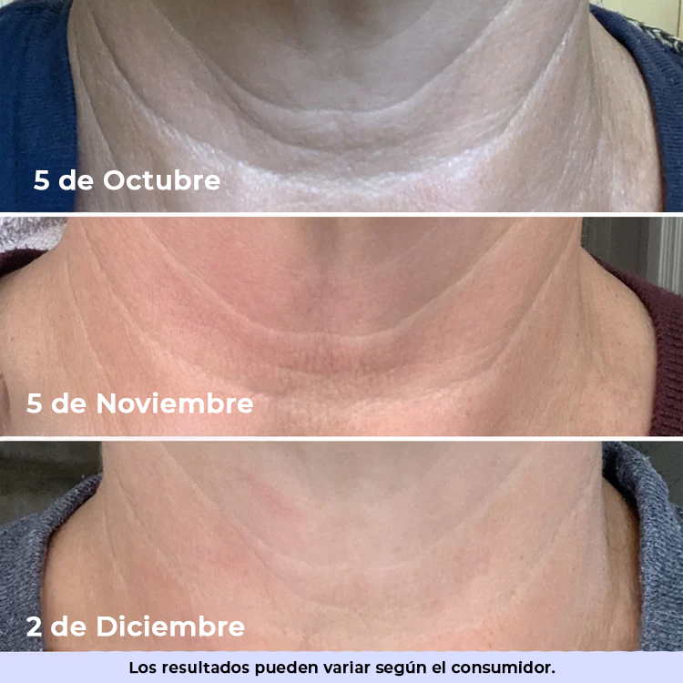 GoPure™ Crema Reafirmante | Transforma tu piel y elimina la flacidez y las arrugas de 4 a 8 semanas