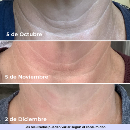 GoPure™ Crema Reafirmante | Transforma tu piel y elimina la flacidez y las arrugas de 4 a 8 semanas