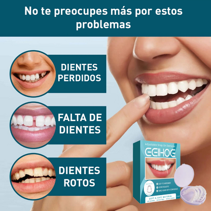 SmileShine™ | ¡Sonríe sin preocupaciones en tan solo 1 segundo!