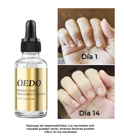 OedoNails™ Extracto para el cuidado de las uñas con veneno de abeja | ¡De suave a hermoso en sólo 14 días!