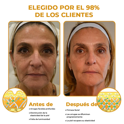 CleanBotox™ Luce hasta 10 años más joven en tan solo 14 días