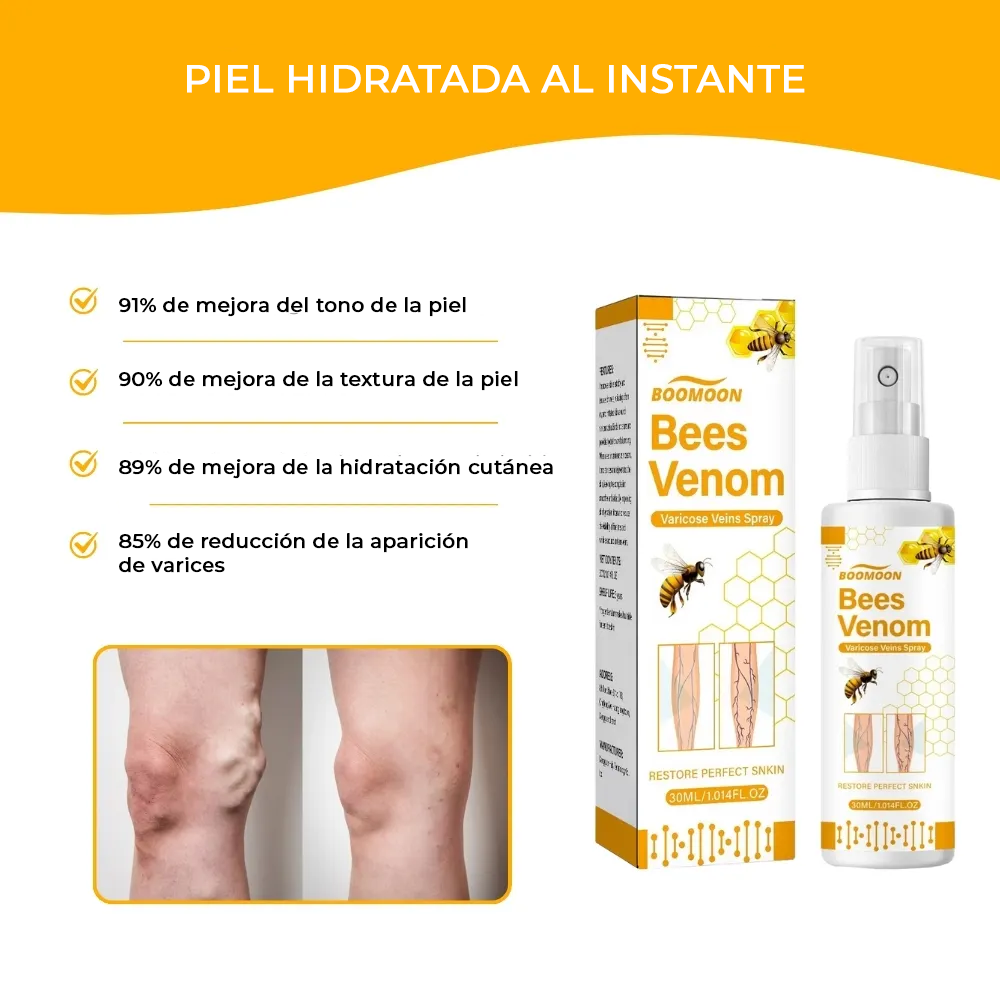 ReliVein®️ | ¡Elimine las venas varicosas en solo una semana!