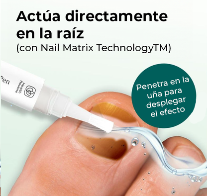 NailCare™ | Elimina los molestos hongos de las uñas en sólo 2 semanas