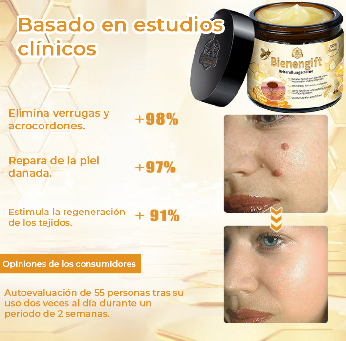 NaturBee™ | Elimina verrugas, granos y lunares en tan solo 7 días