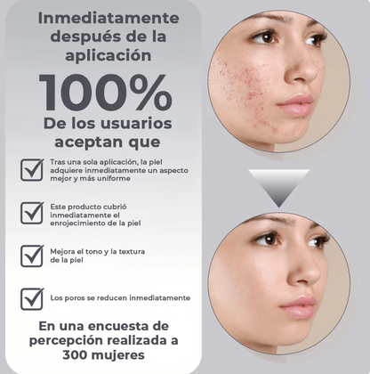 Ricpind™ | Aumenta tu confianza y cubre el 100% de las imperfecciones de tu rostro