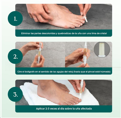 NailCare™ | Elimina los molestos hongos de las uñas en sólo 2 semanas