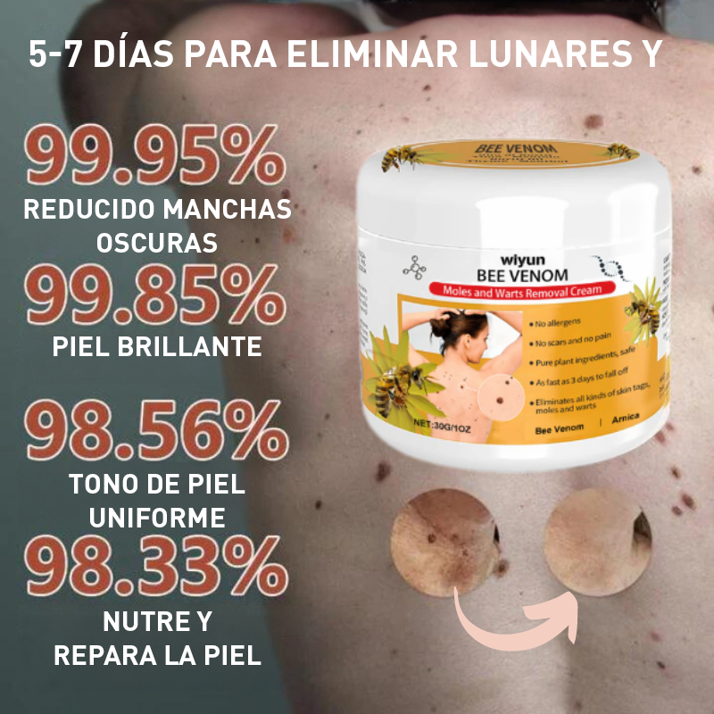 ShineSkin™ | ¡Elimina verrugas, lunares y granos en tan solo 7 días!