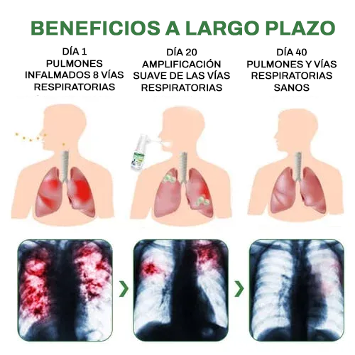 RespiMax™ | Elimina el 98 % de las impurezas pulmonares