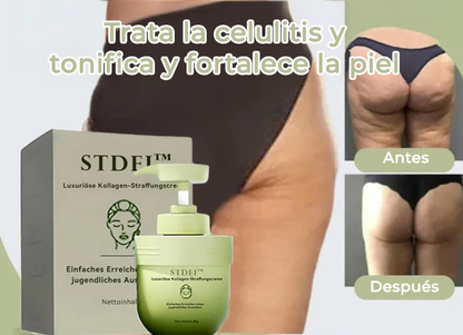 SkinFree™ | Di adiós a la flacidez y revive la firmeza de tu piel en 7 días