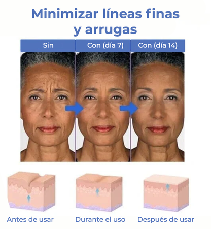 SkinLift™ | ¡Elimina tus arrugas y luce 10 años más joven en 5 días!