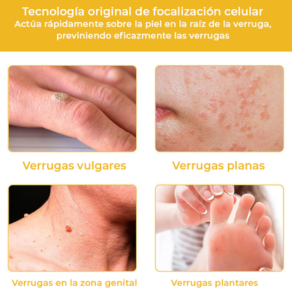 NaturBee™ | Elimina verrugas, granos y lunares en tan solo 7 días