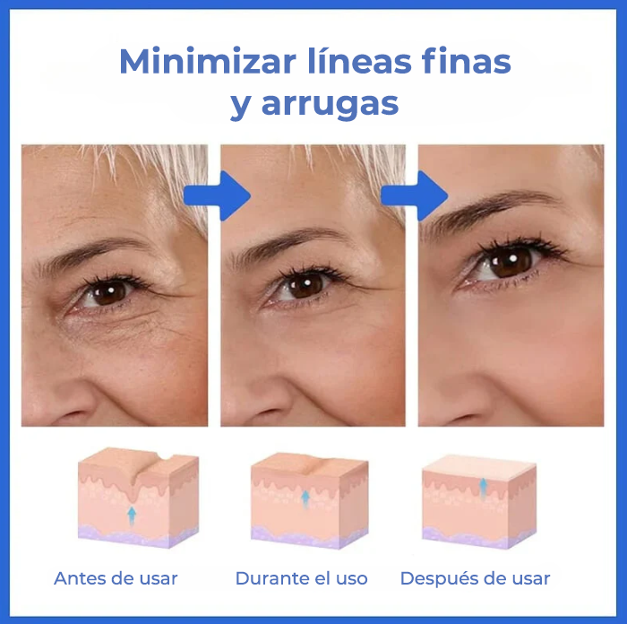 SkinLift™ | ¡Elimina tus arrugas y luce 10 años más joven en 5 días!