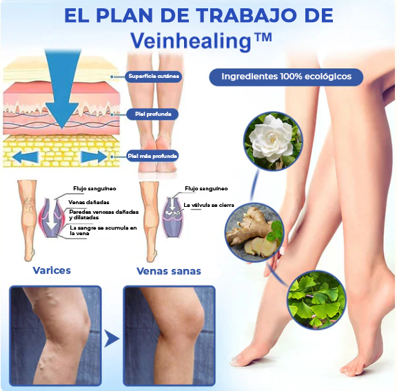 HealVein™ Spray para varices | El tratamiento Nº1 para las venas varicosas recomendado por cardiólogos