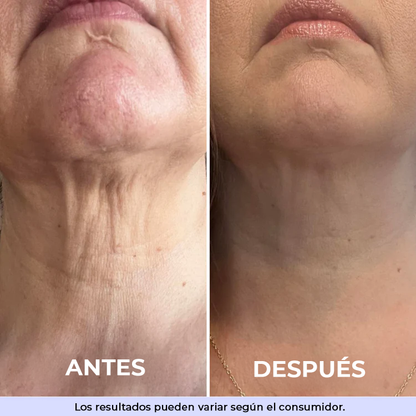 GoPure™ Crema Reafirmante | Transforma tu piel y elimina la flacidez y las arrugas de 4 a 8 semanas