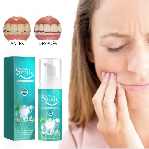 SmartSmile™ | Elimina el sarro y los dientes amarillos en tan solo 7 días